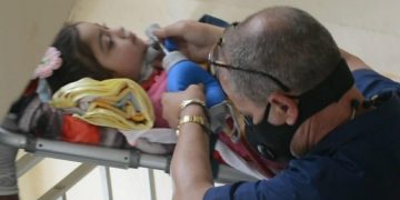 El doctor Enrique Padrón Álvarez,manipulaba el resucitador Ambu para la ventilación manual, a fin de que a la pequeña Yaslin Calderín López (de cuatro años, con una enfermedad degenerativa del Sistema Nervioso Central) no le faltara el oxígeno