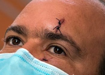 Reinaldo Rosado, profesor de la UCI, víctima de las manifestaciones violentas del pasado domingo. Foto: Abel Padrón Padilla/Cubadebate.