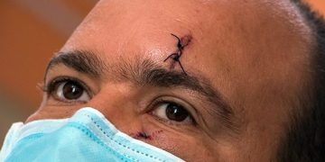 Reinaldo Rosado, profesor de la UCI, víctima de las manifestaciones violentas del pasado domingo. Foto: Abel Padrón Padilla/Cubadebate.