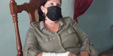 LA MUÑECA de su mano derecha fue enyesada por una fisura debido al forcejeo