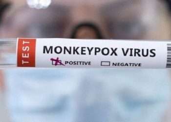 test-positivo-viruela-simica