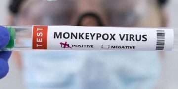 test-positivo-viruela-simica