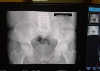 Recibe Artemisa digitalizadores de equipos de Rayos X