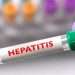 hepatitis-virus