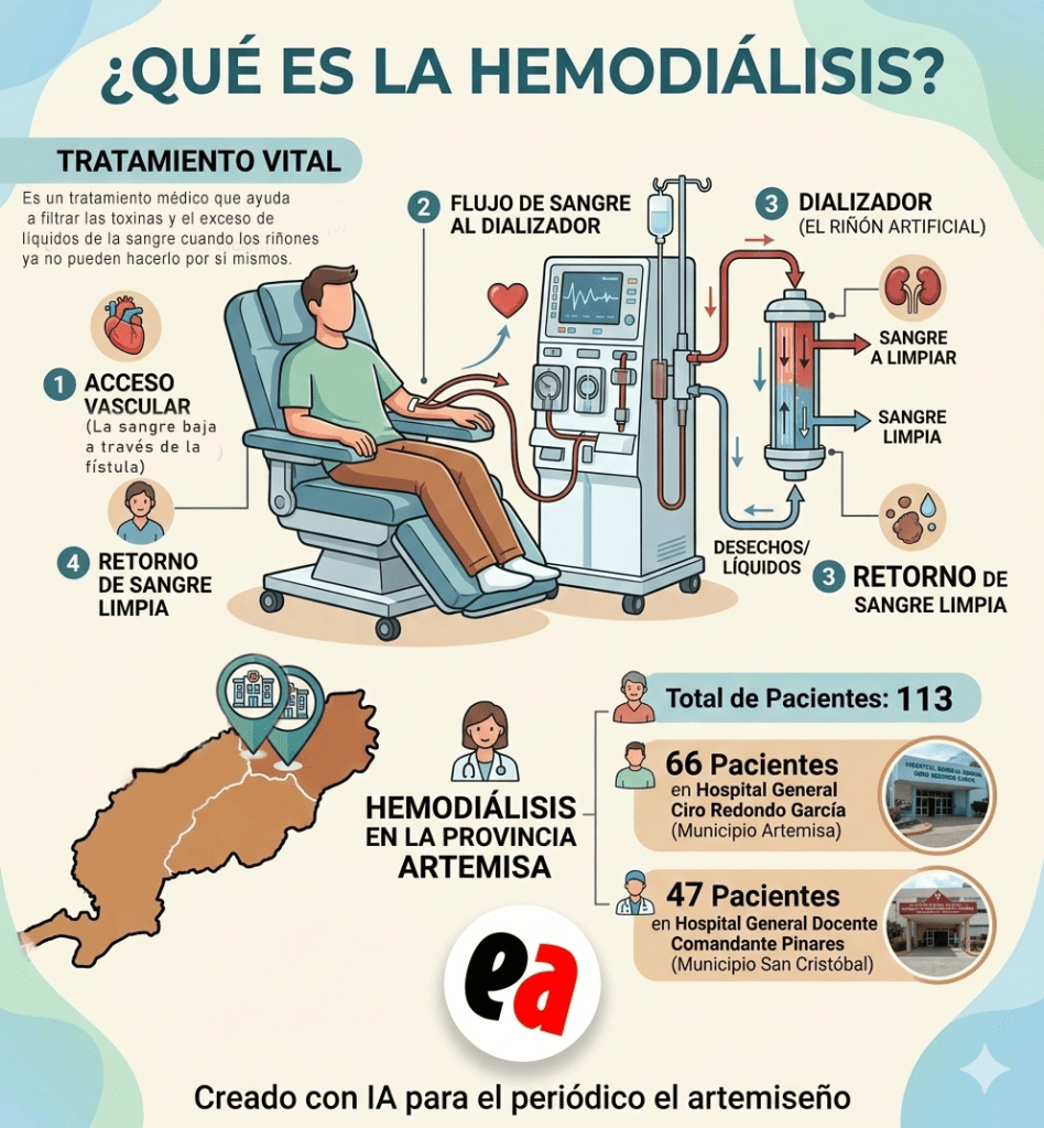 Hemodiálisis. Infografía creada con IA